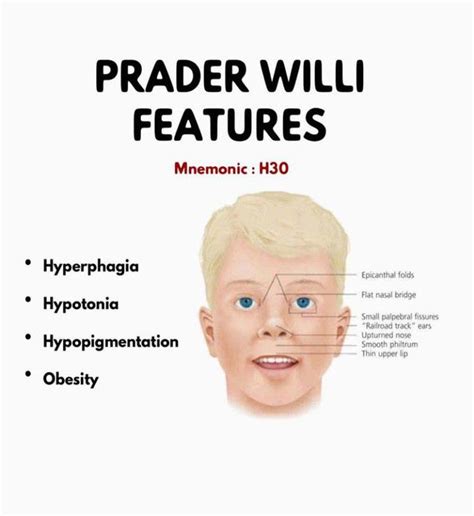 prada wili|prader willi prognosis.